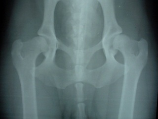 �x���̌Ҋ֐߁i1999/12/15�j